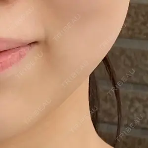 アールクリニック アールクリニック口コミ