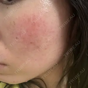 ルラ美容クリニック ルラ美容クリニック 郡山院口コミ