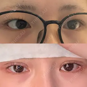 Belle Via Skin Clinic Belle Via Clinic口コミ