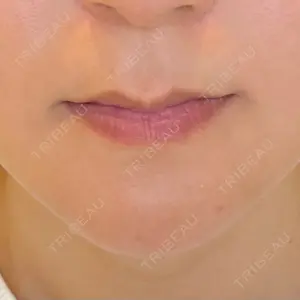 LOUIS CLINIC 二子玉川院【ルイクリニック】口コミ