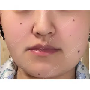 Fellez Clinic【フェルズクリニック】口コミ