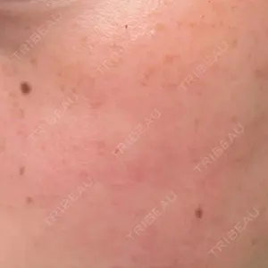 ルラ美容クリニック ルラ美容クリニック 仙台院 / ルラスキンクリニック 仙台院口コミ