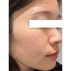 BITO BEAUTY CLINIC BITO BEAUTY CLINIC口コミ