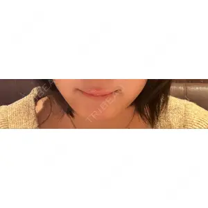 LE CLINIC口コミ