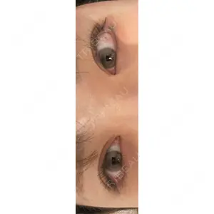プロクリニック PRO CLINIC プロクリニック 銀座院口コミ