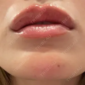 HAAB CLINIC HAAB×DREAM BEAUTY CLINIC 東京本院口コミ