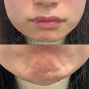 ルラ美容クリニック ルラ美容クリニック 大阪本院口コミ