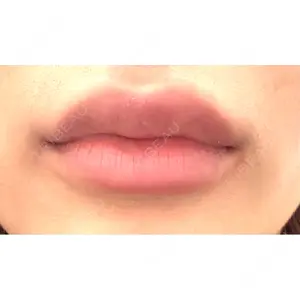 L‘amour clinic Tokyo【ラムールクリニック東京】口コミ