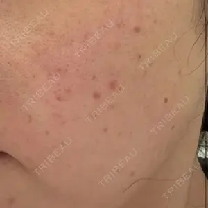 ビラビューティークリニック 博多美容外科/美容皮膚科 ビラビューティークリニック口コミ