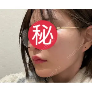 おおたかの森ビューティークリニック おおたかの森ビューティークリニック口コミ