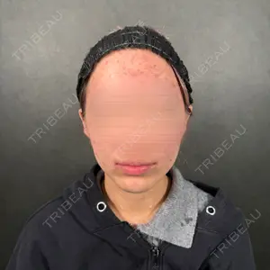 Nebula Clinic 新宿美容外科ネビュラクリニック口コミ