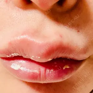 ルラ美容クリニック ルラ美容クリニック 大阪本院口コミ