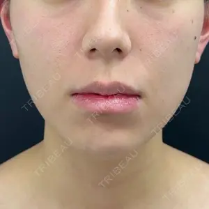 BLINC CLINIC （ブリンク クリニック）口コミ