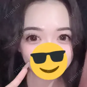 Belle Via Skin Clinic Belle Via Clinic口コミ