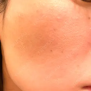 SUNMELIA SKIN CLINIC SUNMELIA SKIN CLINIC口コミ