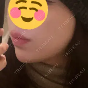 L‘amour clinic Tokyo【ラムールクリニック東京】口コミ