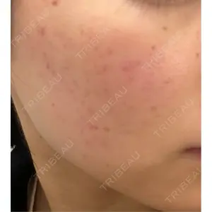 ルラ美容クリニック ルラ美容クリニック 広島院口コミ