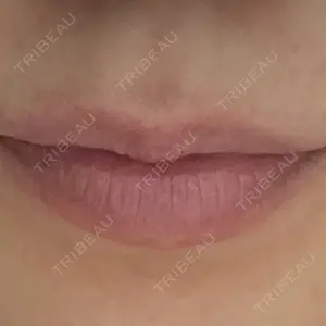 ルラ美容クリニック ルラ美容クリニック 大阪本院口コミ