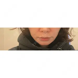 ルラ美容クリニック ルラ美容クリニック 郡山院口コミ