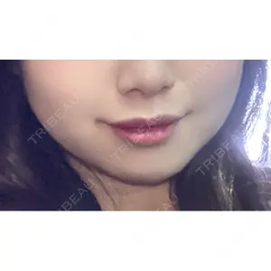 TCB東京中央美容外科 TCB東京中央美容外科 大宮西口院口コミ