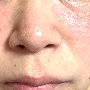 東京シルククリニック 東京シルククリニック 新宿院口コミ