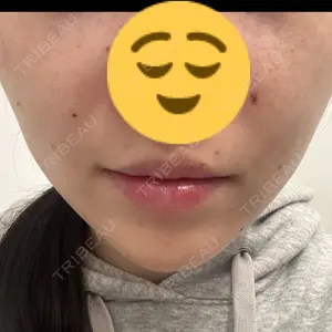口コミ