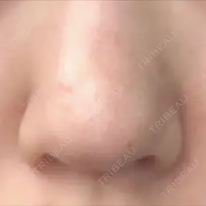リッツ美容外科の口コミ