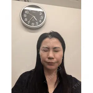 TCB東京中央美容外科 TCB東京中央美容外科 松山院口コミ