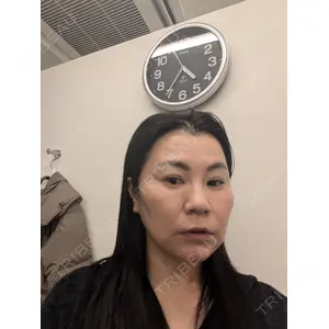 TCB東京中央美容外科 TCB東京中央美容外科 松山院口コミ