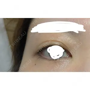 PRISM Beauty Clinic  PRISM Beauty Clinic 新宿院口コミ