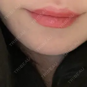 日本美容・医療クリニック 日本美容・医療クリニック 六本木院口コミ