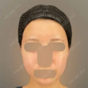 BBC BBC表参道院口コミ