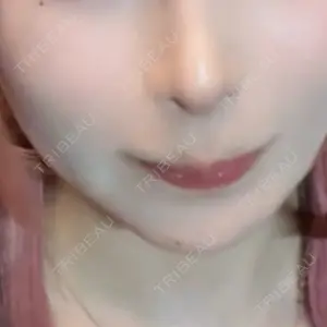 ルラ美容クリニック ルラ美容クリニック 新宿院口コミ