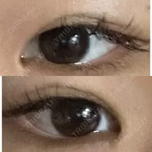 つだ美容外科クリニック つだ美容外科クリニック口コミ