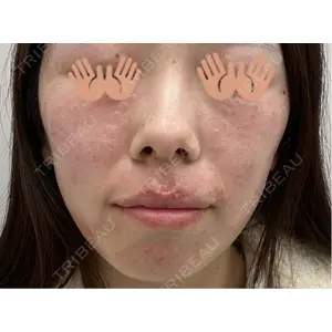 東京シルククリニック 東京シルククリニック 東京神田院口コミ