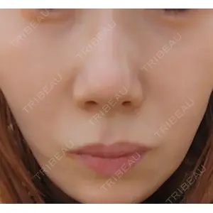 ヴェリテクリニック ヴェリテクリニック 銀座院口コミ