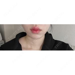 ルラ美容クリニック ルラ美容クリニック 大宮院 / ルラスキンクリニック 大宮院口コミ