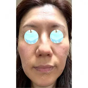 東京シルククリニック 東京シルククリニック 新宿院口コミ