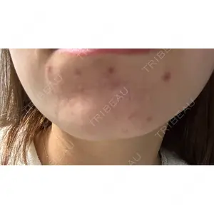 日本美容・医療クリニック 日本美容・医療クリニック 六本木院口コミ