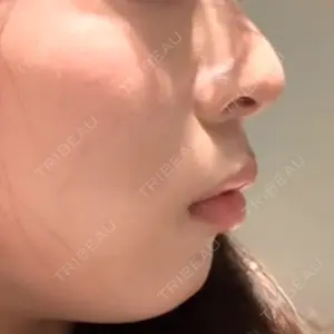 HAAB CLINIC HAAB×DREAM BEAUTY CLINIC 東京本院口コミ