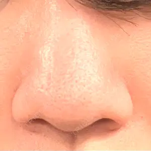 R Beauty CLINIC R Beauty CLINIC 大阪院口コミ