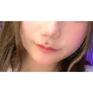 ビューティースキンクリニック ビューティースキンクリニック 池袋院口コミ