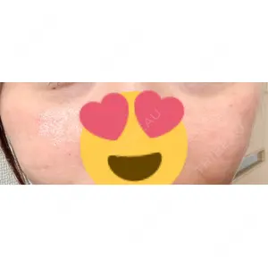 CZEN CLINIC 銀座院口コミ