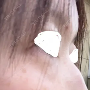 東京BELLEZZAクリニック口コミ
