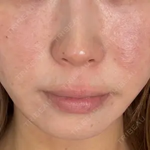 NARU Beauty Clinic NARU Beauty Clinic 【ナルクリ】 水戸院口コミ