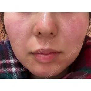 Re:anne clinic 銀座 【リアンクリニック銀座】口コミ