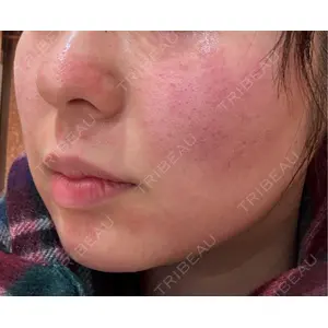 Re:anne clinic 銀座 【リアンクリニック銀座】口コミ