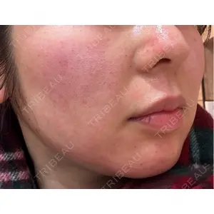 Re:anne clinic 銀座 【リアンクリニック銀座】口コミ