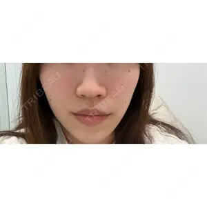 ビラビューティークリニック 博多美容外科/美容皮膚科 ビラビューティークリニック口コミ