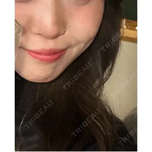 ルラ美容クリニック ルラ美容クリニック 大阪本院口コミ